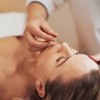 Cosmetic Acupuncture Cosmetic Acupuncture