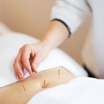 Acupuncture Treatments Acupuncture Treatments